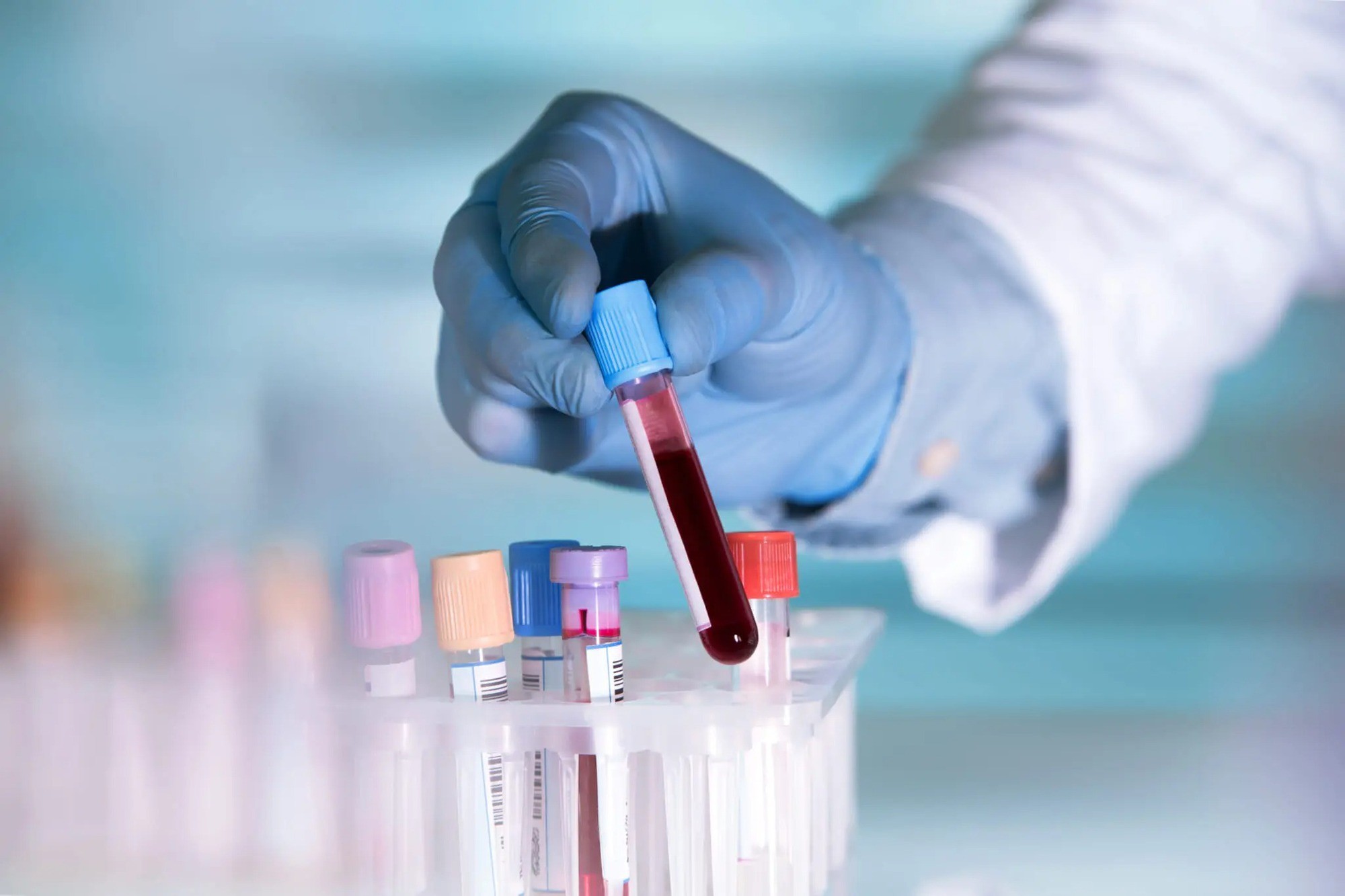 artificial-blood-2048x1365jpg-17520347995851452629776-1752067648853-1752067649085208594858-1752225286.webp