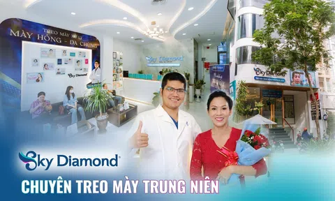 “Bà mẹ lam lũ trên màn ảnh” Mỹ Dung bất ngờ tiết lộ bí mật đi treo mày trị sụp mí