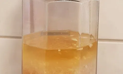 Tỏi ngâm rượu