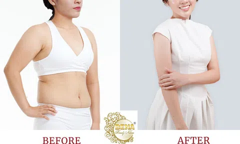 Thẩm mỹ viện giảm béo an toàn, uy tín và hiệu quả tại Cà Mau