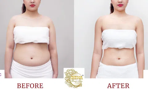 Thẩm mỹ viện giảm béo uy tín tại Quảng Ngãi