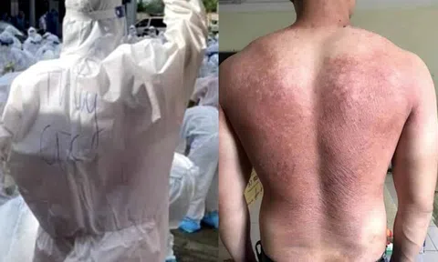 Nữ chiến sĩ Công an với sáng chế áo chống sốc nhiệt kịp chi viện cho tuyến đầu chống dịch