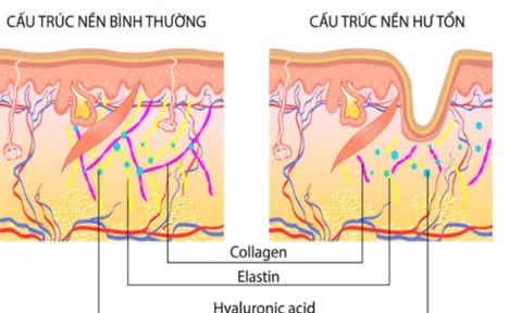 Ra mắt Chỉ Collagen K:OM công nghệ đặc biệt từ Nhật Bản - Tinh hoa chăm sóc da chuyên sâu 