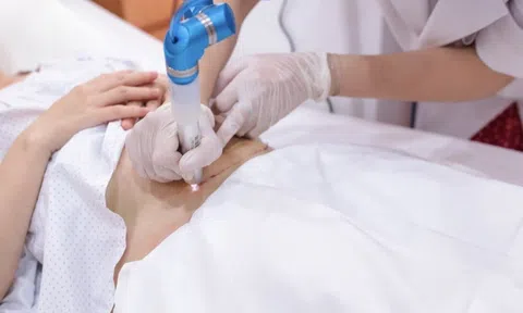 Plasma lạnh trong điều trị sẹo sau nâng ngực: Ưu thế vượt trội so với các phương pháp truyền thống