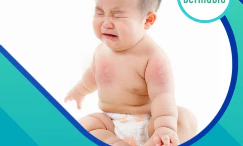 Kinh nghiệm "xương máu" khi lựa chọn sản phẩm chăm sóc da, trị hăm tã cho trẻ