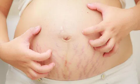 LO LẮNG, MẤT TỰ TIN VÌ RẠN DA – PHẢI LÀM SAO?