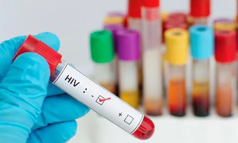 Nam Phi ra mắt thuốc điều trị HIV/AIDS hiệu quả cao