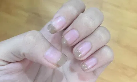 Khoe móng tay nham nhở, hội chị em tất bật đăng ảnh theo trend