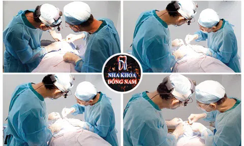 10 lý do nên cấy ghép Implant tại Nha Khoa Đông Nam