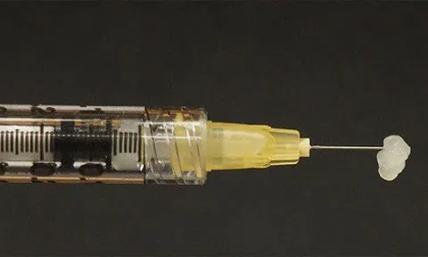 Phát minh loại gel đặc biệt có thể chữa lành mọi vết thương