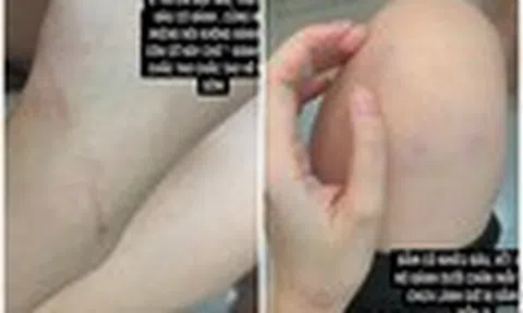 Trai lạ thả tim, cô gái bị người yêu đánh gây bức xúc