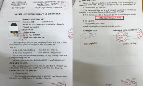 Đồng Nai: Nhiều dấu hiệu bất thường trong vụ án “Cố ý gây thương tích” cần làm rõ để dư luận bớt hoang mang