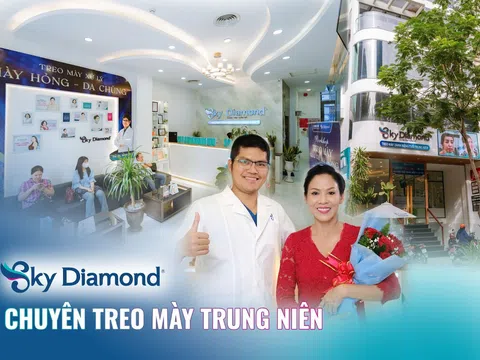 “Bà mẹ lam lũ trên màn ảnh” Mỹ Dung bất ngờ tiết lộ bí mật đi treo mày trị sụp mí