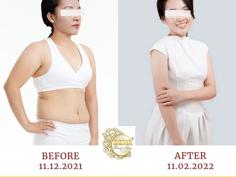Thẩm mỹ viện giảm béo uy tín tại Đắk Lắk