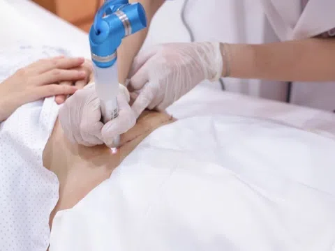 Plasma lạnh trong điều trị sẹo sau nâng ngực: Ưu thế vượt trội so với các phương pháp truyền thống