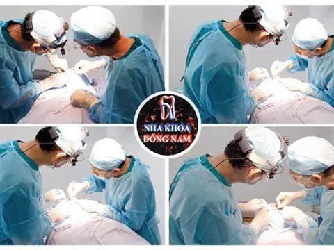 10 lý do nên cấy ghép Implant tại Nha Khoa Đông Nam