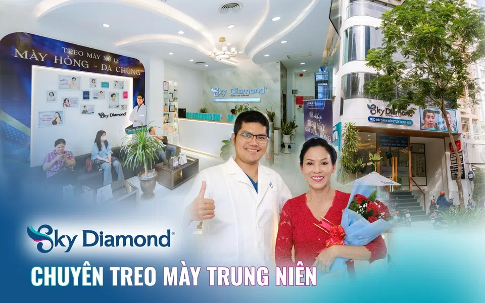 “Bà mẹ lam lũ trên màn ảnh” Mỹ Dung bất ngờ tiết lộ bí mật đi treo mày trị sụp mí